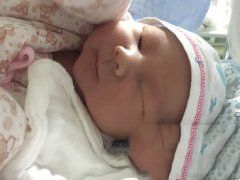 夫妻18年不孕诞下试管婴儿